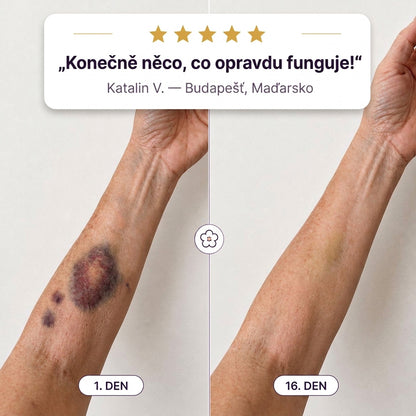 PuraCure® Krém na starostlivosť o modriny a posilnenie pokožky – pre zrelú, tenkú a krehkú pokožku