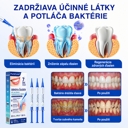 🇸🇰𝑷𝒖𝒓𝒂𝑪𝒖𝒓𝒆® 👨‍⚕️🦷𝑶𝑩𝑵𝑶𝑽𝑨 Ď𝑨𝑺𝑰𝑬𝑵 𝑷𝒂𝒓𝒐𝒅𝒐𝒏𝒕á𝒍𝒏𝒚 𝒐𝒑𝒓𝒂𝒗𝒏ý 𝒈é𝒍🥬