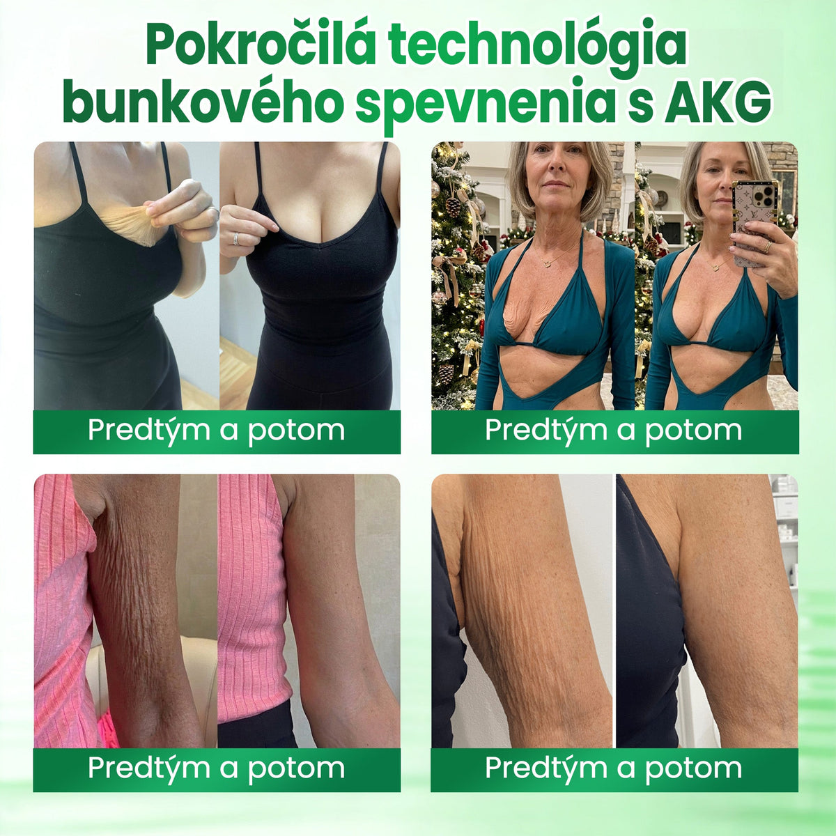 ✨ Medistart® SPEVŇUJÚCA & PROTI STARNUTIU PLEŤOVÁ STAROSTLIVOSŤ