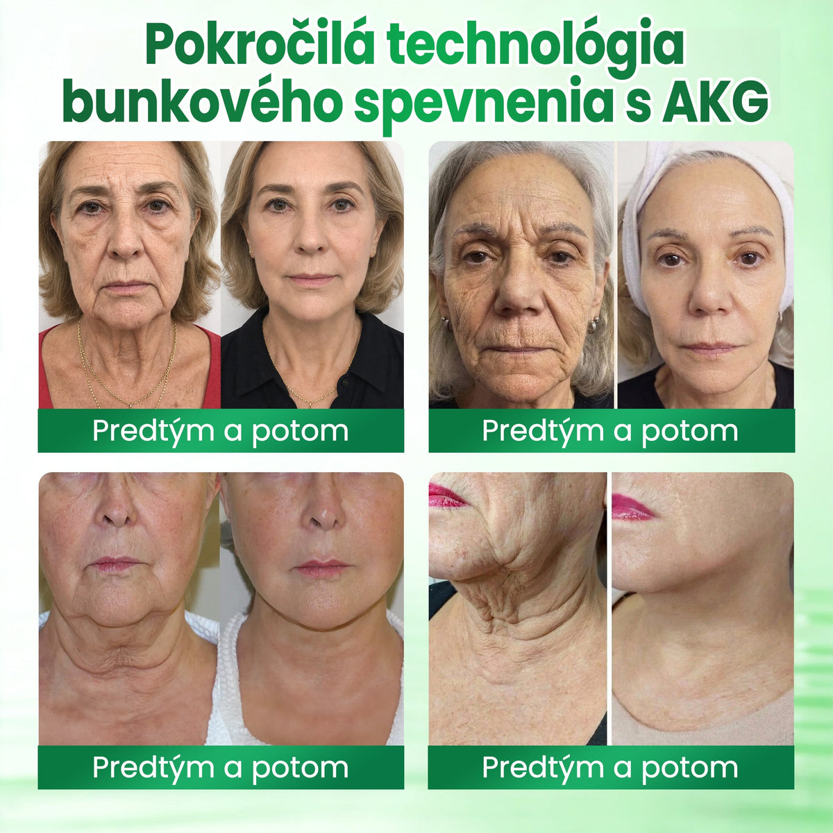 ✨ Medistart® SPEVŇUJÚCA & PROTI STARNUTIU PLEŤOVÁ STAROSTLIVOSŤ