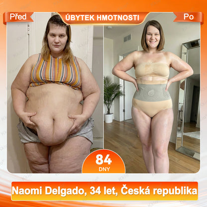 📢 𝐒𝐥𝐞𝐝𝐮𝐣𝐭𝐞 𝐧𝐨𝐯𝐢𝐧𝐤𝐮 – 𝐧𝐨𝐯é 𝐭𝐯𝐚𝐫𝐨𝐯𝐚𝐜í 𝐚 𝐬𝐩𝐚𝐥𝐨𝐯𝐚𝐜í 𝐤𝐫𝐚ť𝐚𝐬𝐲 𝐊𝐤𝐢𝐨® 👩 𝟒 𝐯 𝟏 𝐬 𝐦𝐢𝐤𝐫𝐨ř𝐞𝐳𝐧𝐨𝐮 𝐭𝐞𝐜𝐡𝐧𝐨𝐥𝐨𝐠𝐢í, 𝐬 𝐦𝐨𝐫𝐢𝐧𝐠𝐨𝐮 𝐚 𝐛𝐞𝐫𝐛𝐞𝐫𝐢𝐧𝐞𝐦 ☘️ 𝐏𝐨𝐮𝐳𝐞 𝐧𝐚 𝐨𝐟𝐢𝐜𝐢á𝐥𝐧í𝐦 𝐞-𝐬𝐡𝐨𝐩𝐮 𝐳𝐧𝐚č𝐤𝐲 | ✅ 𝐎𝐫𝐢𝐠𝐢𝐧á𝐥𝐧í 𝐩𝐫𝐨𝐝𝐮𝐤𝐭
