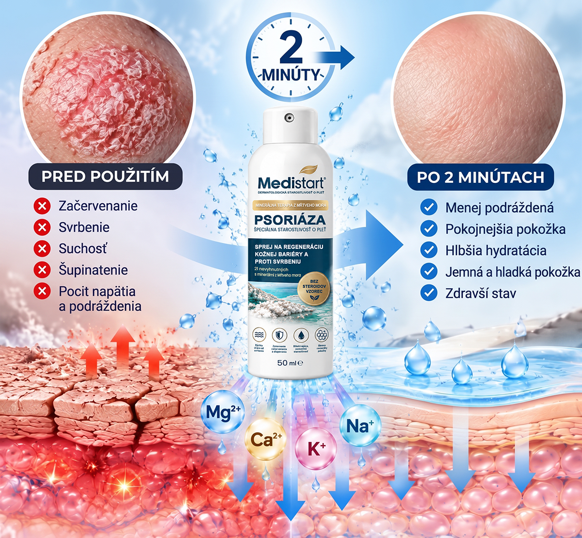 🌿Medistart® ŠPECIÁLNA STAROSTLIVOSŤ O POKOŽKU PRI PSORIÁZE