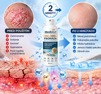 🌿Medistart® ŠPECIÁLNA STAROSTLIVOSŤ O POKOŽKU PRI PSORIÁZE