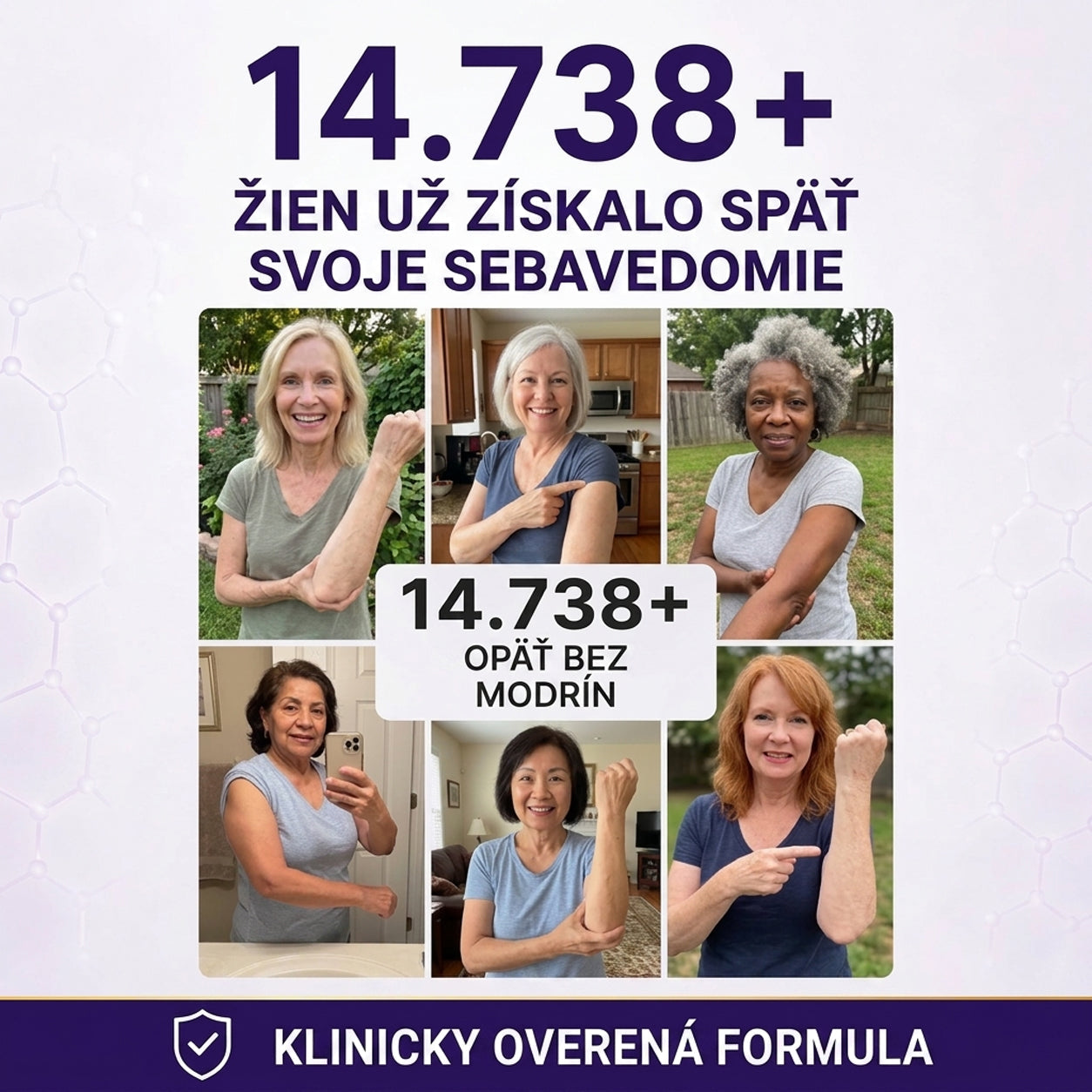 PuraCure® Krém na starostlivosť o modriny a posilnenie pokožky – pre zrelú, tenkú a krehkú pokožku