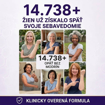 PuraCure® Krém na starostlivosť o modriny a posilnenie pokožky – pre zrelú, tenkú a krehkú pokožku