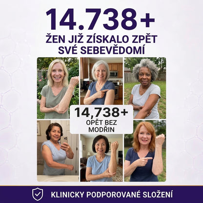 PuraCure® Krém na starostlivosť o modriny a posilnenie pokožky – pre zrelú, tenkú a krehkú pokožku