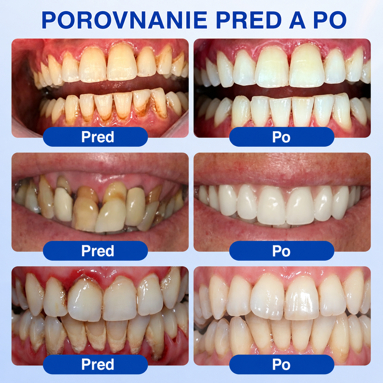 🇸🇰𝑷𝒖𝒓𝒂𝑪𝒖𝒓𝒆® 👨‍⚕️🦷𝑶𝑩𝑵𝑶𝑽𝑨 Ď𝑨𝑺𝑰𝑬𝑵 𝑷𝒂𝒓𝒐𝒅𝒐𝒏𝒕á𝒍𝒏𝒚 𝒐𝒑𝒓𝒂𝒗𝒏ý 𝒈é𝒍🥬