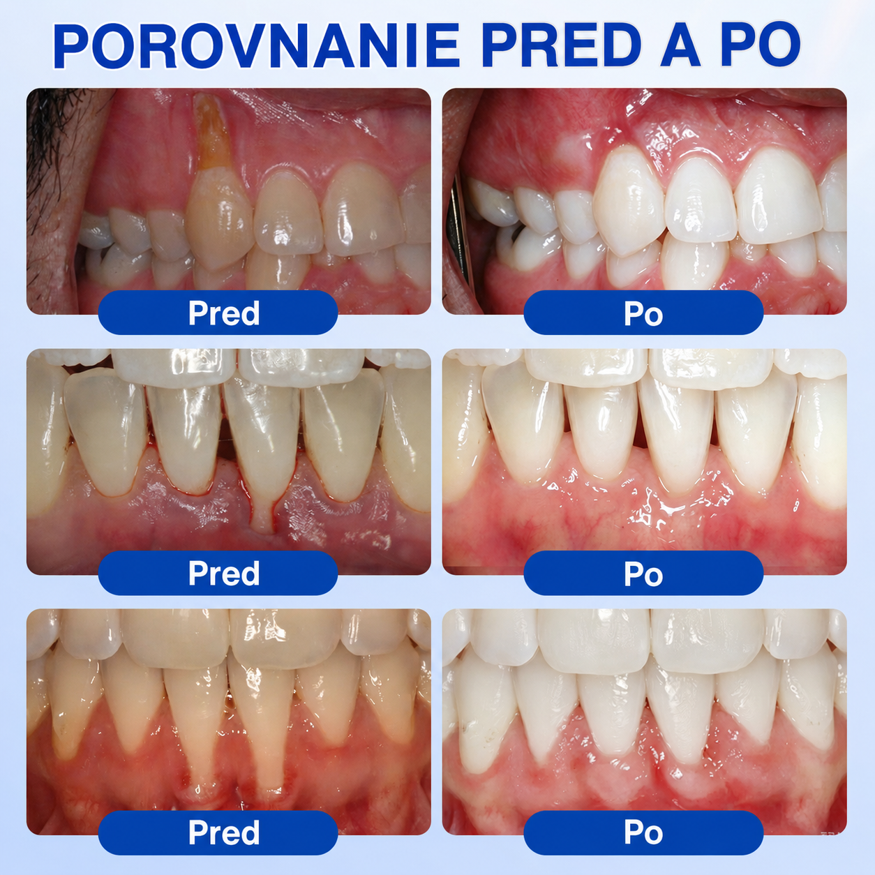 🇸🇰𝑷𝒖𝒓𝒂𝑪𝒖𝒓𝒆® 👨‍⚕️🦷𝑶𝑩𝑵𝑶𝑽𝑨 Ď𝑨𝑺𝑰𝑬𝑵 𝑷𝒂𝒓𝒐𝒅𝒐𝒏𝒕á𝒍𝒏𝒚 𝒐𝒑𝒓𝒂𝒗𝒏ý 𝒈é𝒍🥬